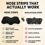 Deep Cleansing Nose Strips