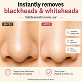 Deep Cleansing Nose Strips