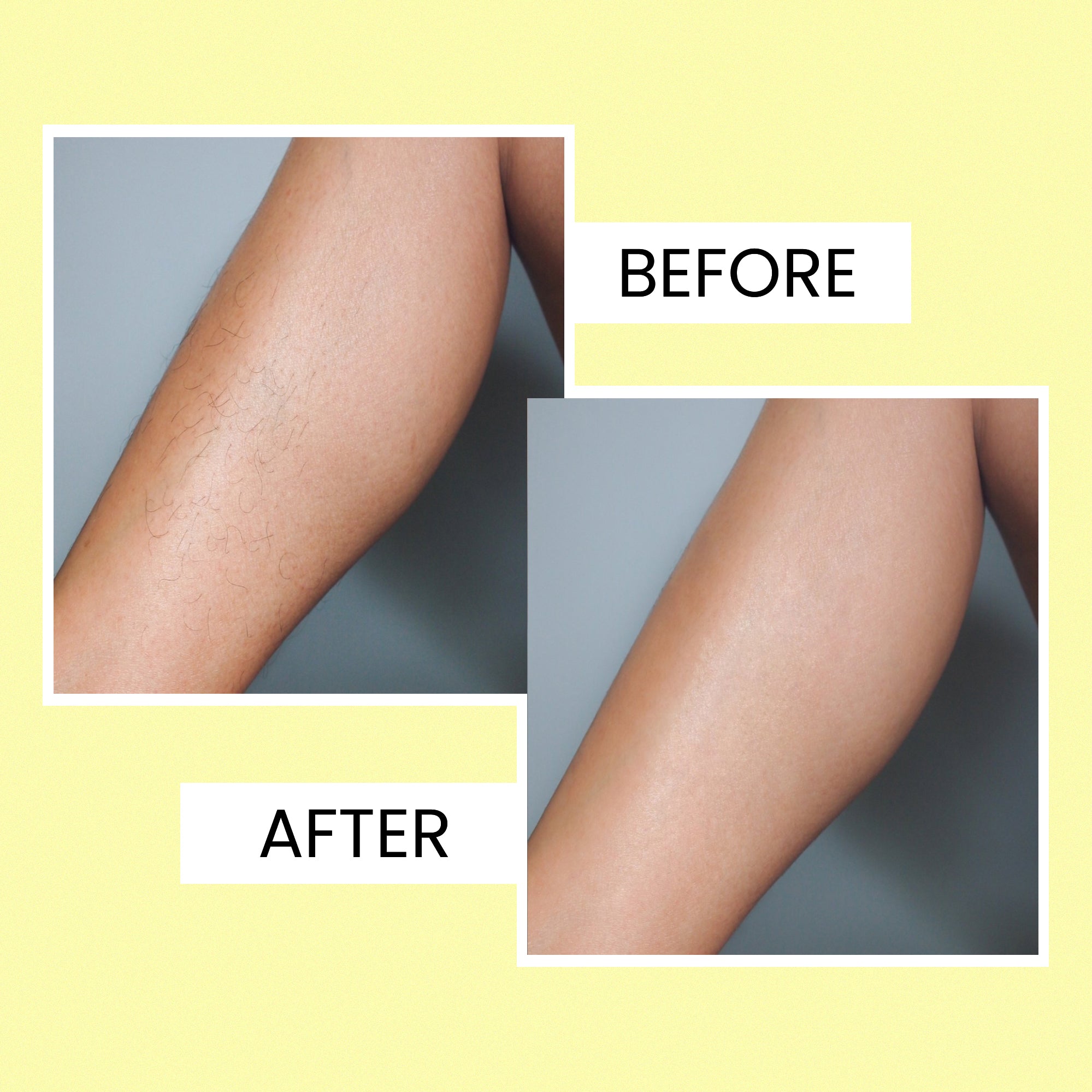 Body Wax Strips for Women | Quick &amp; Easy Hair Removal for Legs &amp; Arms| 20 waxing strips | 1 pcs. finish wipes