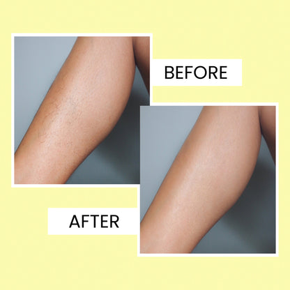 Body Wax Strips for Women | Quick &amp; Easy Hair Removal for Legs &amp; Arms| 20 waxing strips | 1 pcs. finish wipes