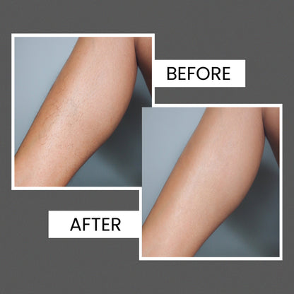 Body Wax Strips for Women | Quick &amp; Easy Hair Removal for Legs &amp; Arms| 20 waxing strips | 1 pcs. finish wipes