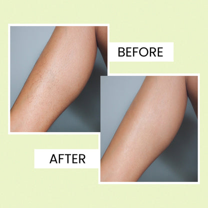 Body Wax Strips for Women | Quick &amp; Easy Hair Removal for Legs &amp; Arms| 20 waxing strips | 1 pcs. finish wipes